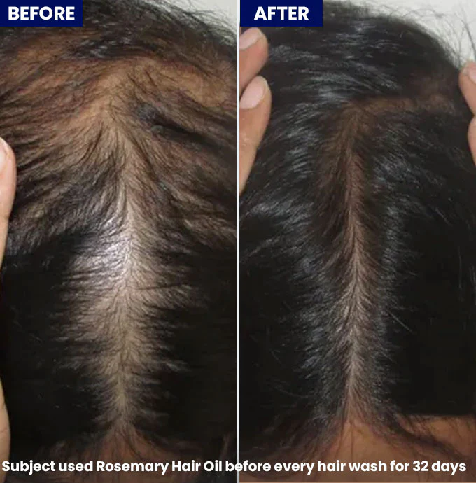 Anagrow Rosemary Hair Oil - Image 4