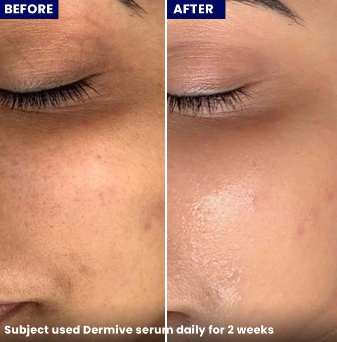 Dermive Hydrating Serum - Image 5