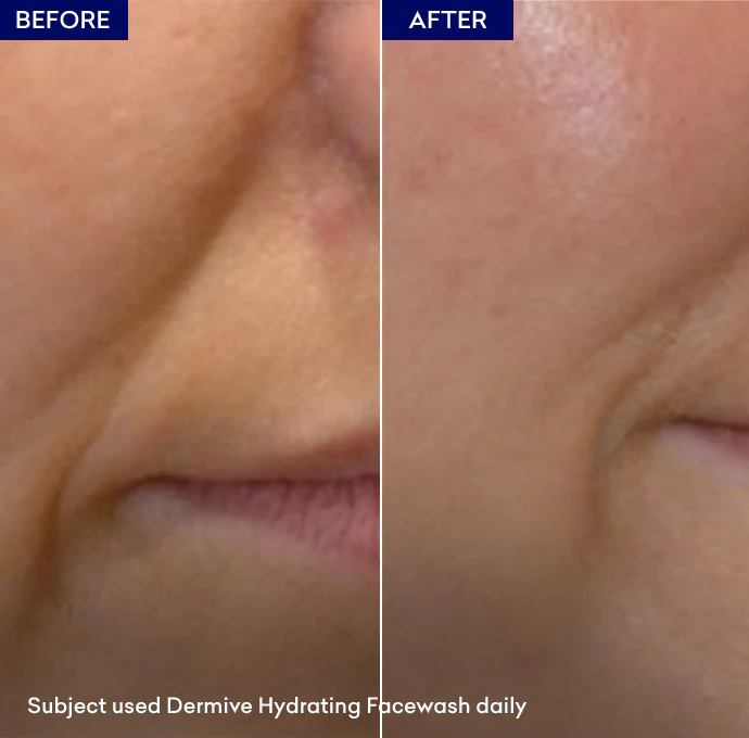 Dermive Moisturizing Wash - Image 6
