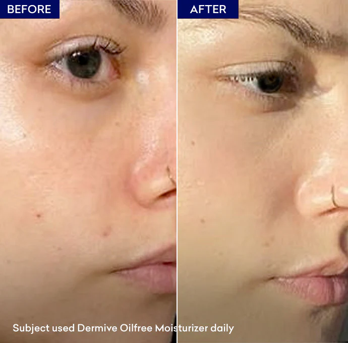 Dermive Oil Free Moisturizer - Image 6