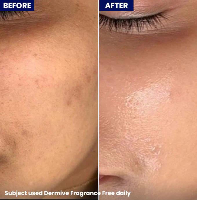 Dermive Oil-Free Fragrance Free Moisturizer - Image 4