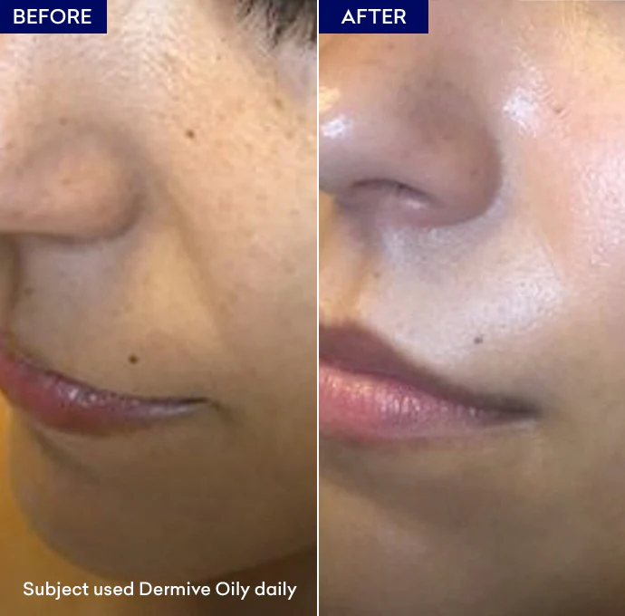Dermive Oily - Image 6