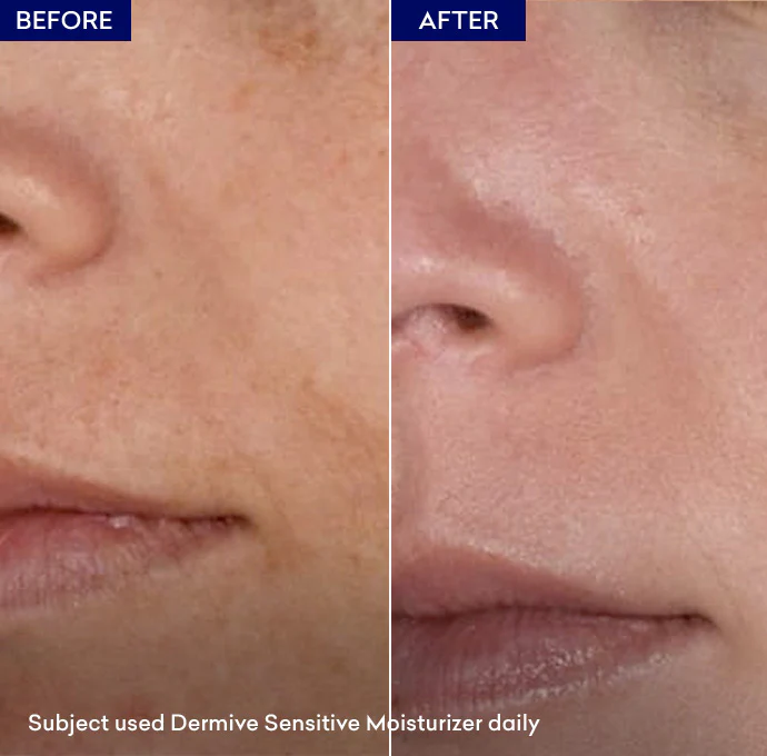 Dermive Sensitive Moisturizer - Image 5