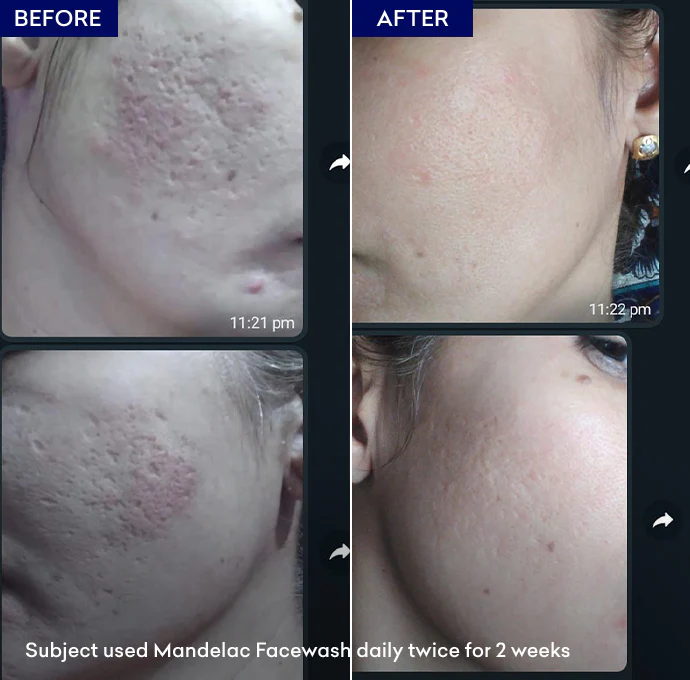 MandelAC Facewash - Image 6