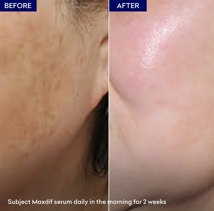Maxdif Brightening Serum - Image 6